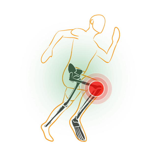 Injury Recovery
